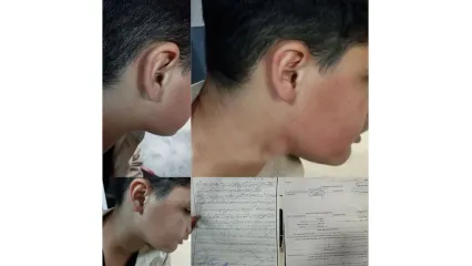 لغو ابلاغ معلم خاطی در پی تنبیه بدنی دانش  آموز لاهیجانی