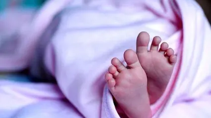 وحشتناک ترین نوزاد دنیا در بنگلادش به دنیا آمد+ عکس