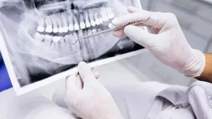 دردناک ولی واقعی: کشیدن دندان به خاطر نداشتن هزینه درمان