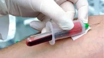 علائم ، درمان و هر آن چیزی که باید درباره غلظت خون بدانید + ویدیو