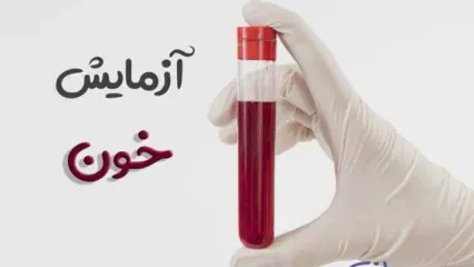 کلسترول خون کودک را چک کنید + کلیپ