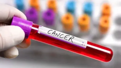 چرا برخی سرطان ها بعد از درمان عود می‌کنند؟