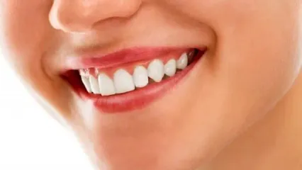 ۱۰ راز سفید کردن دندان‌ها در خانه