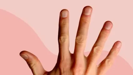 تشخیص کدام سرطان از روی ناخن ها امکان پذیر است؟