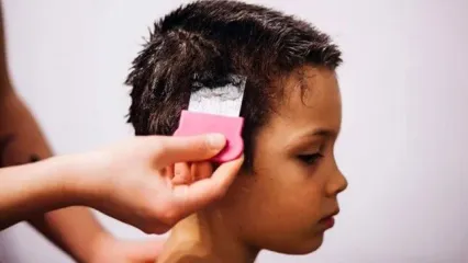 ریزش مو در کودکان تا چه حد طبیعی است؟ 0 تا 100 دلایل + راهکار
