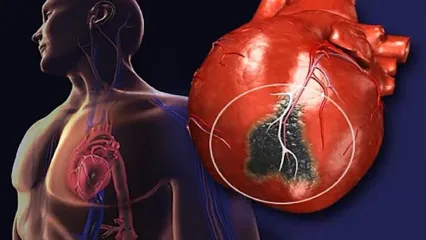 8 سیگنال اخطار بدن یک ماه قبل از حمله قلبی + اینفوگرافیک