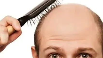 ۶ روش علمی که سفید شدن موهایتان را به تأخیر می‌اندازد