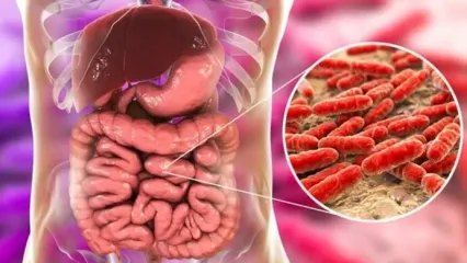 سرطان روده: علائم، پیشگیری و اهمیت تشخیص زودهنگام