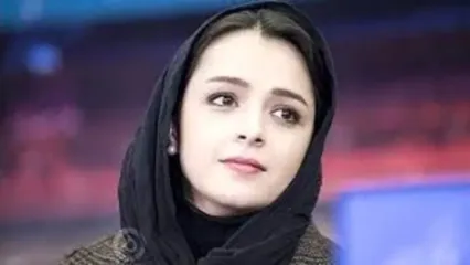 عکسی از چهره لاغر ترانه علیدوستی پربازدید شد