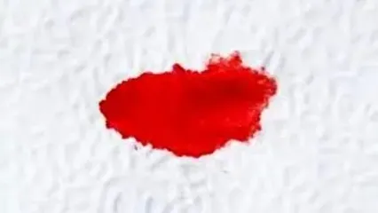 درمان خونریزی بعد از رابطه جنسی!