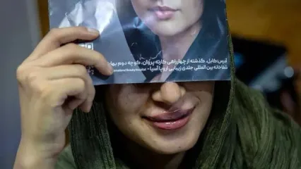 ببینید؛ رواج جراحی‌های زیبایی در کابل زیر سایه طالبان؛ از بوتاکس تا کاشت مو