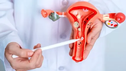 نفخ مداوم می‌تواند نشانه‌ای از سرطان تخمدان باشد