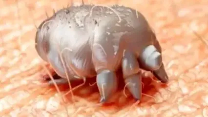 در مورد بیماری گال چه می دانید؟