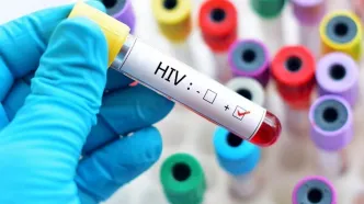 آخرین وضعیت HIV در کشور مشخص شد / راه های انتقال ایذر