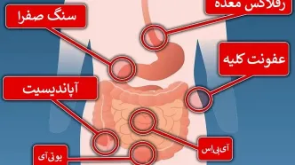 درد هر قسمت از شکم نشان دهنده چه مشکلی است؟