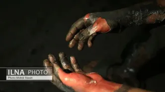 مصدومان چهارشنبه سوری در بیمارستان شهید مطهری