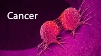 انتشار جدول جهانی شیوع سرطان ها در کشورها/ ایران به کدام نوع از سرطان شناخته شده است؟