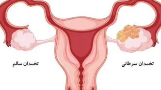 فریز تخمک برای چه کسانی توصیه میشود + ویدیو