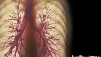 رباتی که از یک پزشک بیشتر سر در می آورد سرطان ریه را تشخیص داد + ویدیو