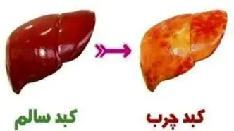 این میوه خوشمزه هم کبد چرب را درمان می‌کند هم باعث طول عمر می‌شود