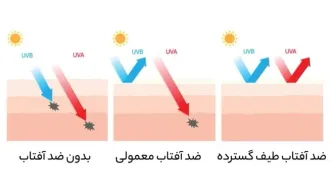 ضد آفتاب طیف گسترده چیست و چرا متخصصین پوست پیشنهادش میکنند؟