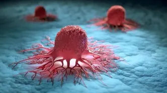 تشخیص سریع و موثر سرطان روده بزرگ: آزمایش‌های ضروری