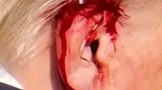 تصویری جالب از عبور گلوله از کنار سر ترامپ + تصویر