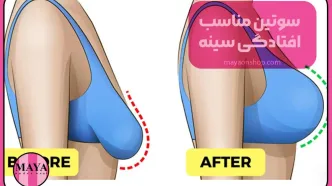 سوتین مناسب افتادگی سینه