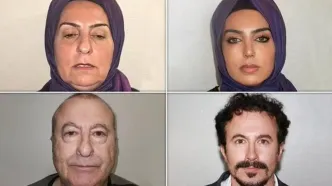 کلینیک جراحی پلاستیک در استانبول؛ نمونه کارها جعلی یا واقعی؟
