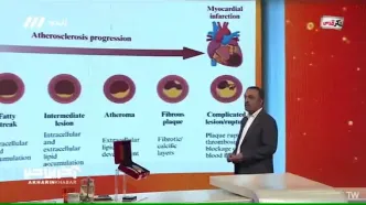 علت اصلی سکته قلبی چیست؟ پاسخ این سوال را در این ویدیو ببینید