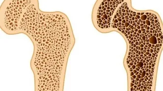 این علائم نشانه پوکی استخوان است