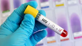 HIV؛ بیماری عفونی و قابل کنترل