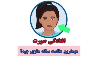 سکته مغزی چیست؟ + فیلم