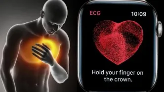 واردات اپل واچ دردسرساز شد