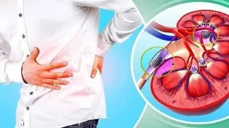 با این نوشیدنی‌ها، سنگ کلیه را شکست دهید!
