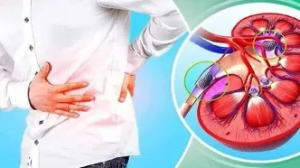 نوشیدنی‌هایی که به دفع سنگ کلیه کمک می‌کنند