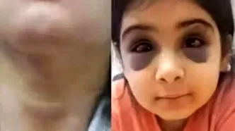 کودک ۹ ساله سنندجی قربانی خشونت نامادری/ پرونده به دادگستری ارجاع شد