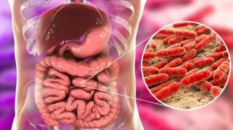سرطان روده: علائم، پیشگیری و اهمیت تشخیص زودهنگام
