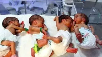 زن زاهدانی که چهار فرزند داشت، چهار قلو به دنیا آورد