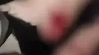 فیلم هانی کرده بعد از اصابت گلوله پلیس به پاهایش !