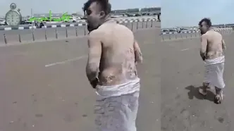 تصاویر دلخراش ۱۸+ از قربانی انفجار بندر شهید رجایی