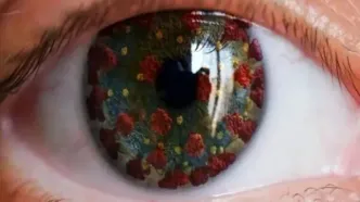 10 علامت مهم کرونای چشمی که باید جدی بگیرید