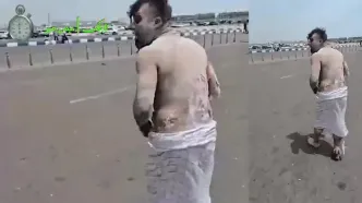 تصاویر دلخراش ۱۸+ از قربانی انفجار بندر شهید رجایی