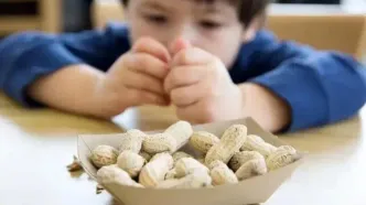 راهکاری برای کاهش احتمال آلرژی غذایی در کودکان