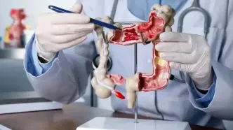 سرطان روده به زیر ۴۰ سال رسید؛ ۶۰ درصد ایرانی‌ها اضافه‌وزن دارند