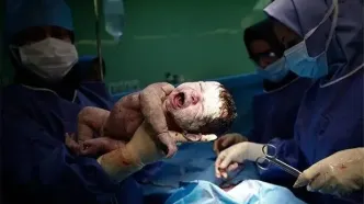 نرخ‌های نجومی زایمان در بیمارستان‌های خصوصی/ هزینه سرسام‌آور سزارین+نمودار