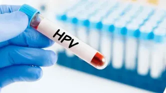 واکسن HPV ایرانی وارد بازار شد