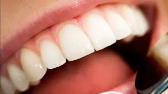 این خوراکی‌ها دهان را بدبوتر می‌کنند