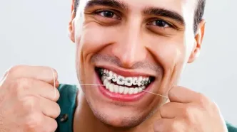 هزینه ارتودنسی دندان چقدر است؟