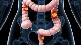 رابطه پنهان قند و سرطان؛ آیا شیرینی‌ها تومور را تغذیه می‌کنند؟